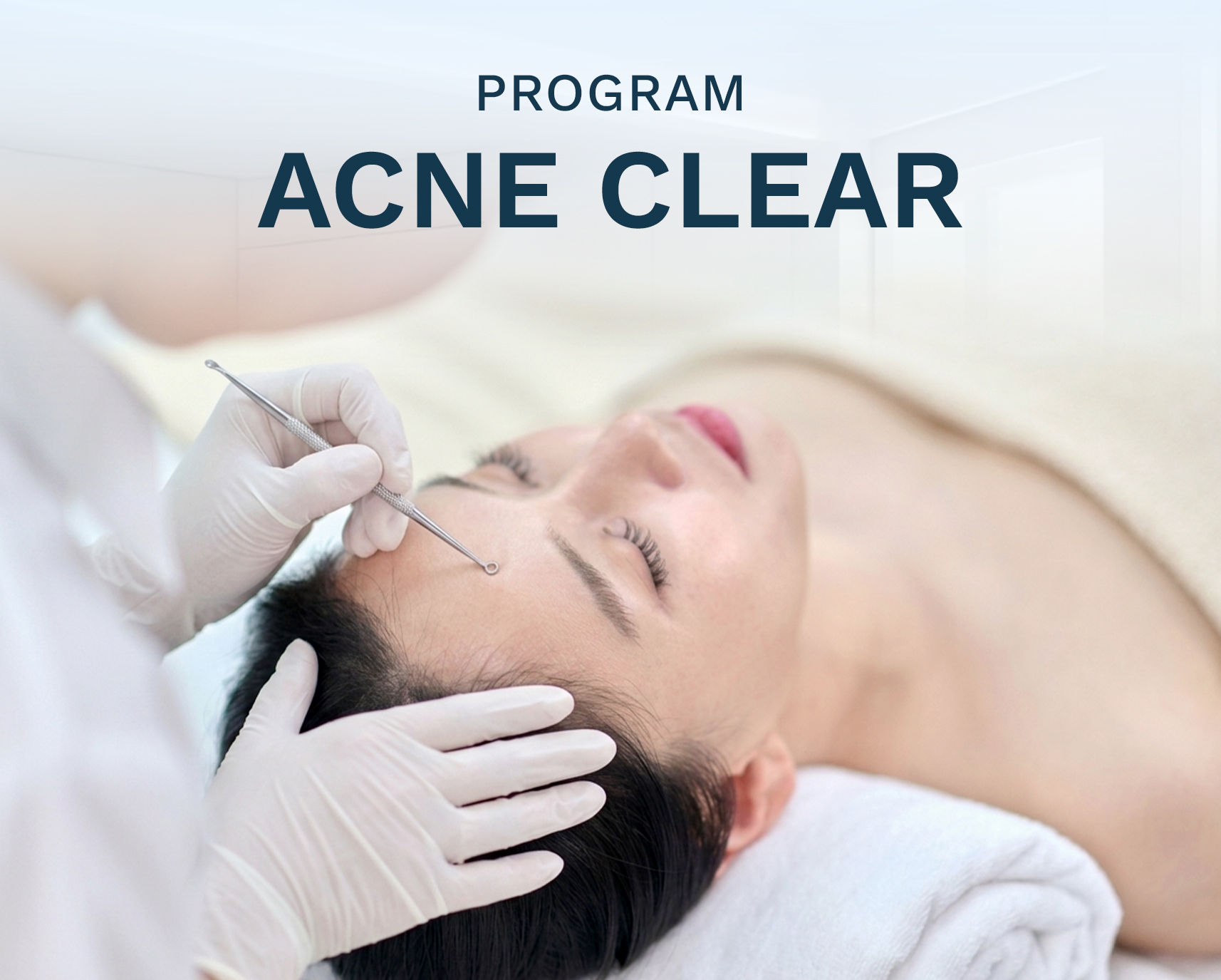 Acne Clear